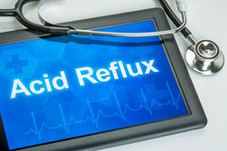 Natural Remedies For Acid Reflux | Globe Life