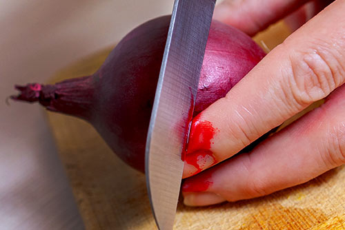 Hazards in the Kitchen: What You Do Every Day that Puts You at Risk for a Serious Accident | Globe Life